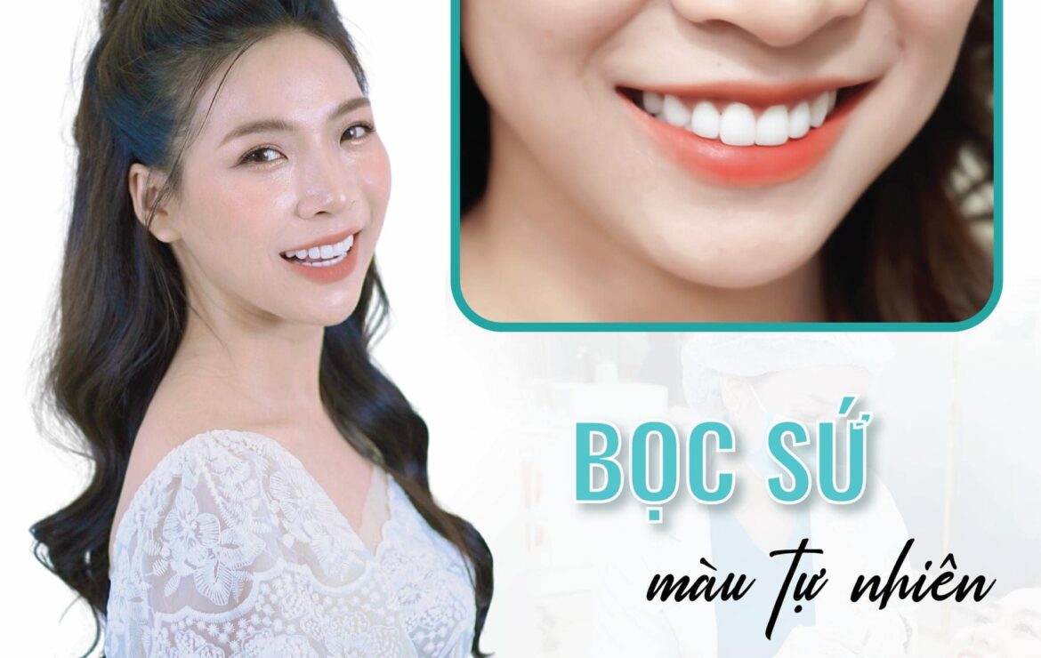 Bọc răng sứ sợ nhất là giả trân