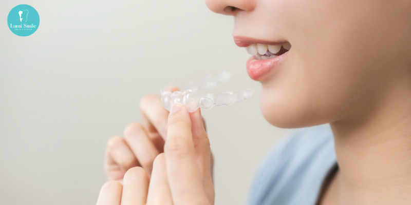 Niềng răng Invisalign