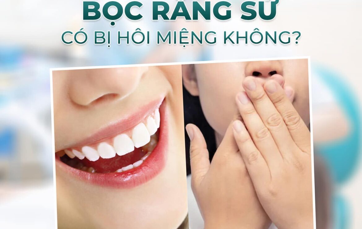 Giải đáp thắc mắc bọc răng sứ có bị hôi miệng không?