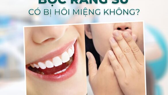 Giải đáp thắc mắc bọc răng sứ có bị hôi miệng không?