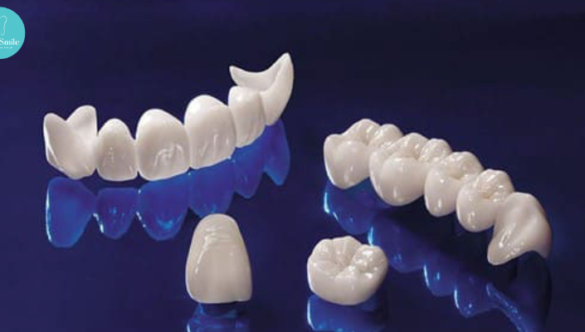 Răng sứ Zirconia và những thông tin bạn cần biết