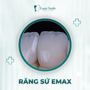 răng sứ thẩm mỹ sử dụng được bao lâu